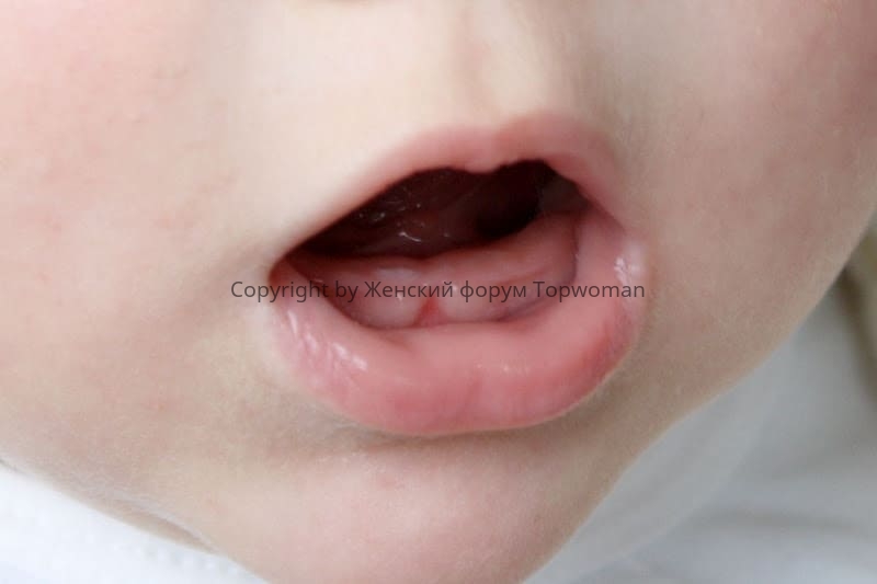 Какие зубы у ребёнка прорезываются первыми